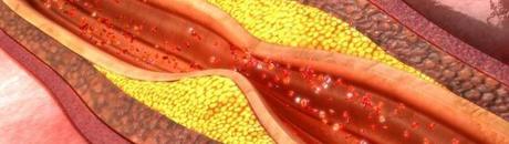 El colesterol: ¿qué tipos hay, cómo te afecta y por qué deberías controlarlo? colesterol