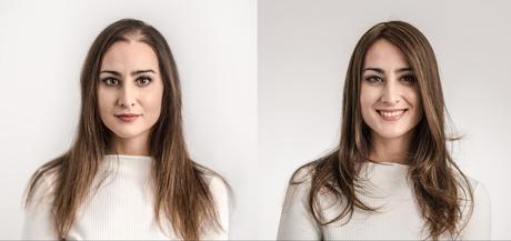 protesis capilar hair inspira barcelona