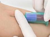 Desarrollan nuevo análisis sangre detecta grave será infección Coronavirus