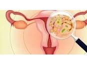 aborto relaciona cambios bacterias vaginales