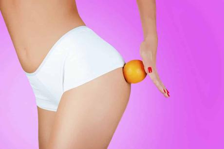 Como deshacerte de la celulitis rápida y naturalmente es ... eliminar la celulitis