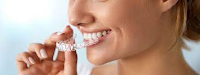 Alternativas a Invisalign