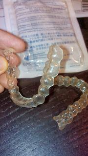 Los retenedores, 1 año despues