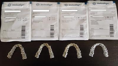 Los retenedores, 1 año despues