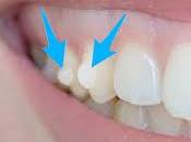 OTRO "chof" grande...