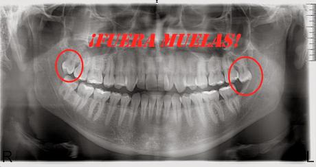 Nueva visita y noticia inquietante...