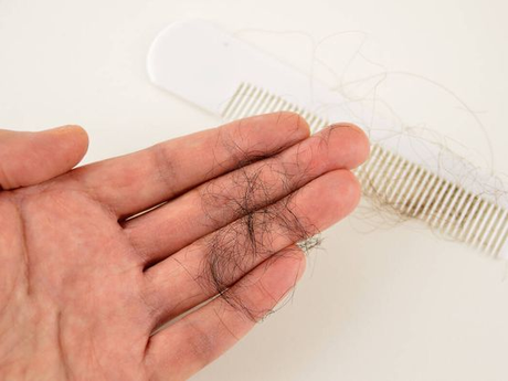 ¿Cuál es el mejor tratamiento para la caída del pelo?