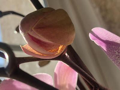 Entre Cafés... Endoscopia y Arroz con Secreto y Ajestes. Entre Cafés... Endoscopia y Arroz con Secreto y Ajestes.