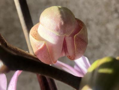 Entre Cafés... Endoscopia y Arroz con Secreto y Ajestes. Entre Cafés... Endoscopia y Arroz con Secreto y Ajestes.