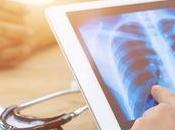 Principales enfermedades pulmonares graves