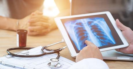 Enfermedades pulmonares graves Neumonia