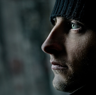 Un paciente de 26 años se disloca el colgajo LASIK mientras se ajusta la mascarilla.