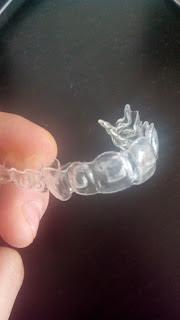 ferula ataches invisalign paletas