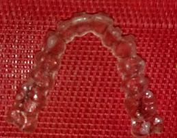 ferula sucia ataches invisalign