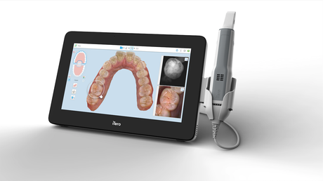 ¿Cómo creó la NASA tus brackets dentales?