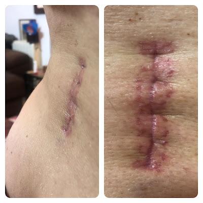 Entre cafés, médicos y notas.