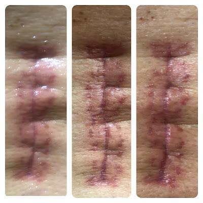 Entre cafés, médicos y notas.