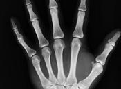 Alimentos Calcio lácteos