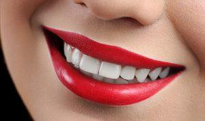 5 consejos para elegir el mejor blanqueamiento dental - Trucos de salud caseros