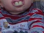 Cuantos dientes debería tener