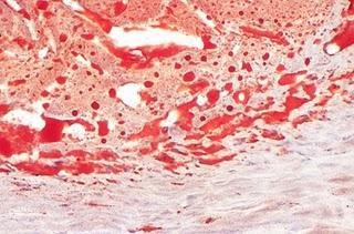 Técnicas de tinción