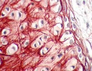 Técnicas de tinción