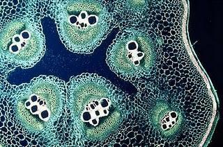 Técnicas de tinción