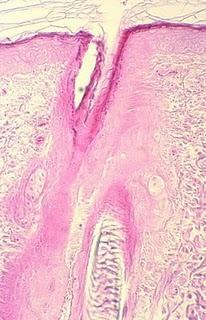 Técnicas de tinción