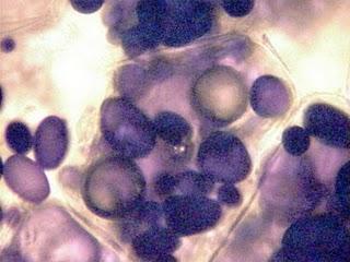 Técnicas de tinción