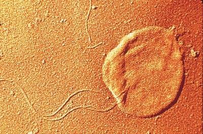 La Célula Procariota