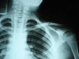 rayosx Estudios afirman que las radiografías y resonancias son innecesarias y exponen a la radiación