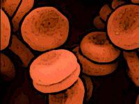 ¿Qué es la anemia?