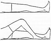 Ejercicios Pilates para quienes tengan prótesis de cadera