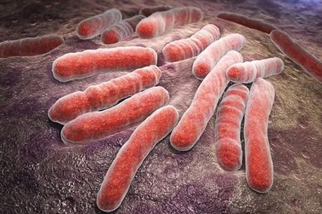 Tuberculosis