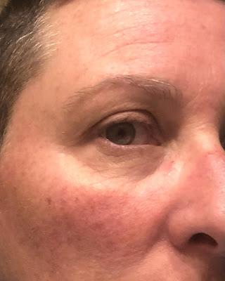 Piel-reactiva Piel-reactiva