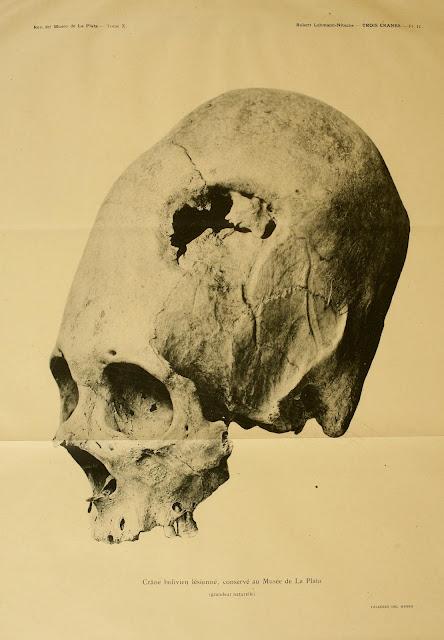 Los excepcionales conocimientos médicos de los incas Los excepcionales conocimientos médicos de los incas