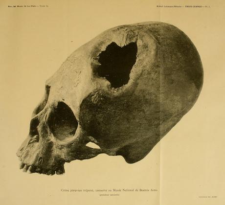 Los excepcionales conocimientos médicos de los incas Los excepcionales conocimientos médicos de los incas