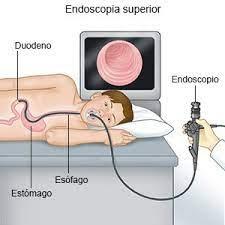 Endoscopia Endoscopia
