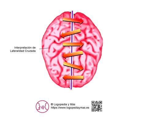 que es la lateralidad cruzada