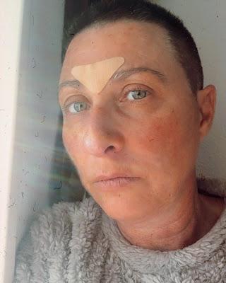 Parche Facial APRICOT  Hyaluron . Viernes de Spa