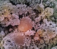 Un Antiviral Nasal bloquea la infección por SARS-CoV-2 Un Antiviral Nasal bloquea la infección por SARS-CoV-2