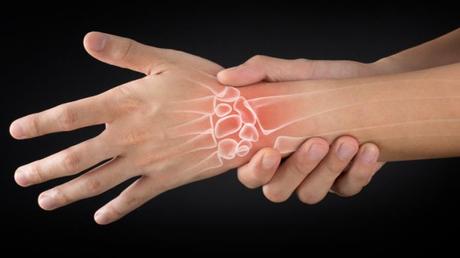 medicina natural para la artritis reumatoide