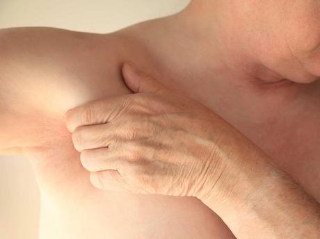 Bulto en la axila: Todo lo que necesitas saber Bulto en axila