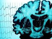 Nuevo Tratamiento para Autismo Epilepsia