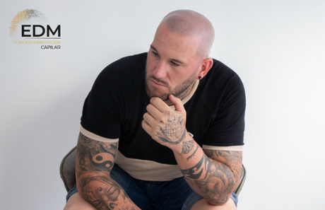 La clínica EDM Capilar explica la micropigmentación capilar