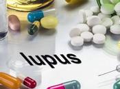 claves lupus cutáneo: ahora vemos casos esta enfermedad autoinmune