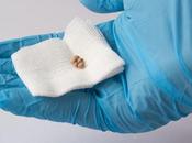 Piedras vesícula