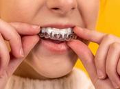 tratamiento ortodoncia invisible elegir