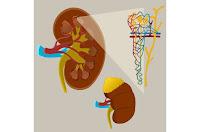 La lesión renal por COVID es más común de lo esperado La lesión renal por COVID es más común de lo esperado