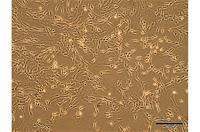 Frenan la Hipertensión Pulmonar utilizando Células Madres